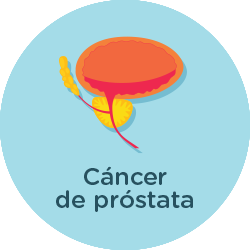 Prostata